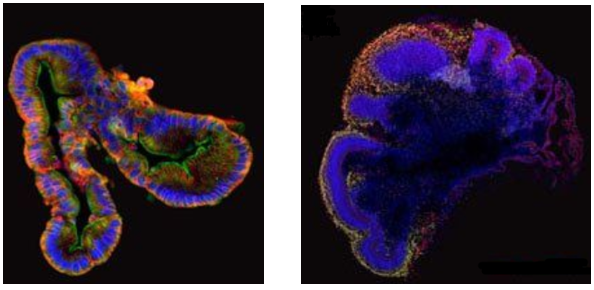 SX: Organoide intestinale umano (STEMCELL Technologies)
DX: Organoide celebrale umano (STEMCELL Technologies)